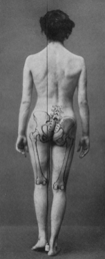 Another early 1930's image that shows what improper posture does to the alignment of the spine